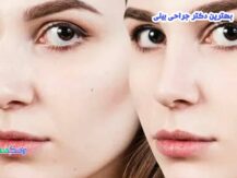 جراحی بینی در بعثت شیراز