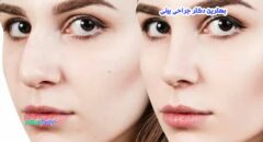 جراحی بینی در بعثت شیراز