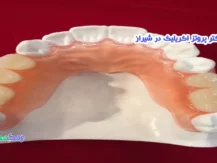 دکتر پروتز اکریلیک در شیراز