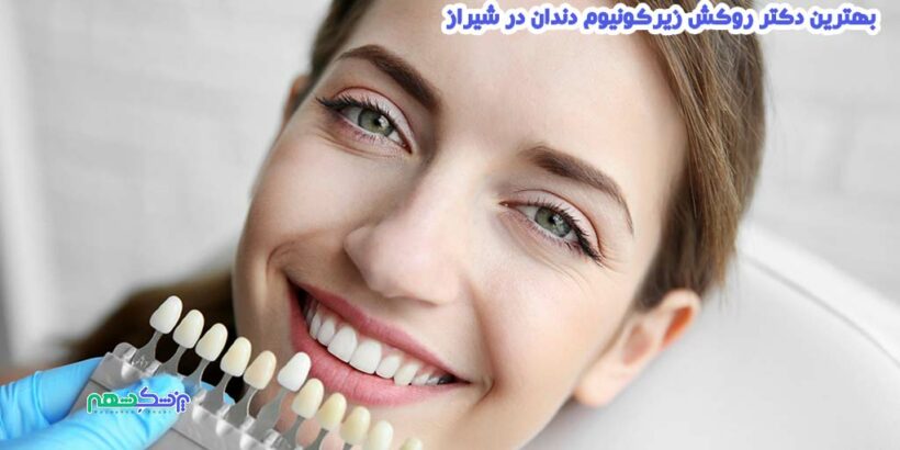 روکش زیرکونیوم دندان در شیراز