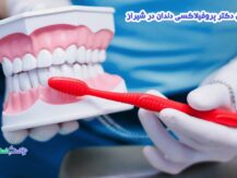 بهترین دکتر پروفیلاکسی دندان در شیراز