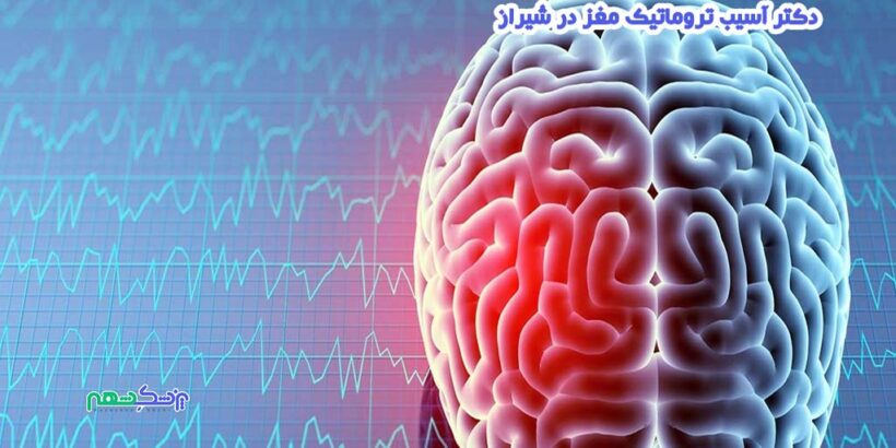 دکتر آسیب تروماتیک مغز در شیراز