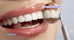 کامپوزیت دندان در صدرا