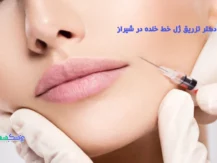 دکتر تزریق ژل خط خنده در شیراز
