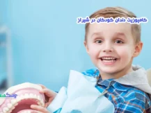 کامپوزیت دندان کودکان در شیراز