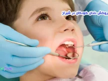 روکش دندان کودکان در شیراز