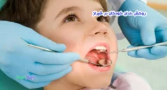 روکش دندان کودکان در شیراز