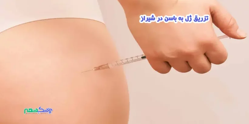 تزریق ژل به باسن در شیراز