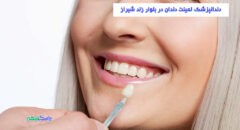دندانپزشک لمینت دندان در بلوار زند شیراز