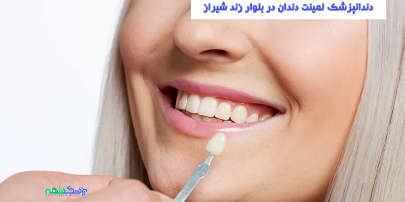دندانپزشک لمینت دندان در بلوار زند شیراز