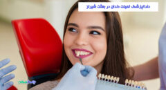 دندانپزشک لمینت دندان در بعثت شیراز
