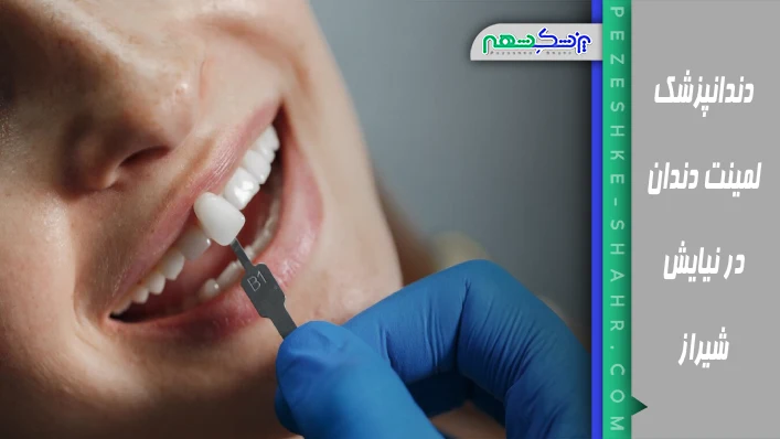 دندانپزشک لمینت دندان در نیایش شیراز