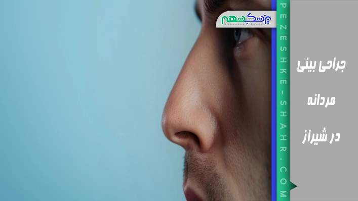 جراحی بینی مردانه در شیراز