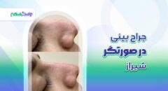 جراح بینی در صورتگر شیراز