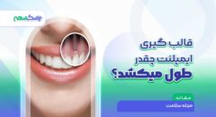قالب گیری ایمپلنت چقدر طول میکشد؟