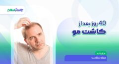 40 روز بعد از کاشت مو + عکس کاشت و 8 نکته مراقبتی