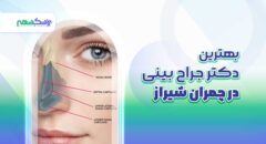 بهترین دکتر جراح بینی در چمران شیراز