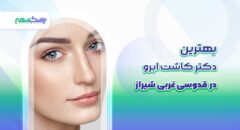 بهترین دکتر کاشت ابرو در قدوسی غربی شیراز
