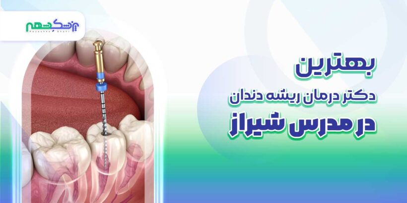 بهترین دکتر درمان ریشه دندان در مدرس شیراز