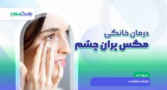 درمان خانگی مگس پران چشم