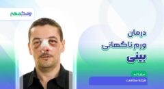 درمان ورم ناگهانی بینی