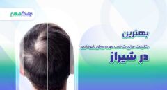 بهترین کلینیک های کاشت مو به روش بایوفایبر در شیراز